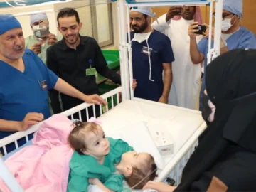 The start of the process of separating the Syrian twin "Celine and Eileen"
 Arabausa