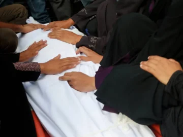 "the worst starvation" kills gaza children with "sentence"
 arabausa