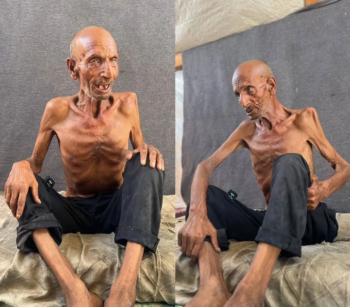 Salim abforne ... the victim of Israeli and hunger in Gaza
Arabausa