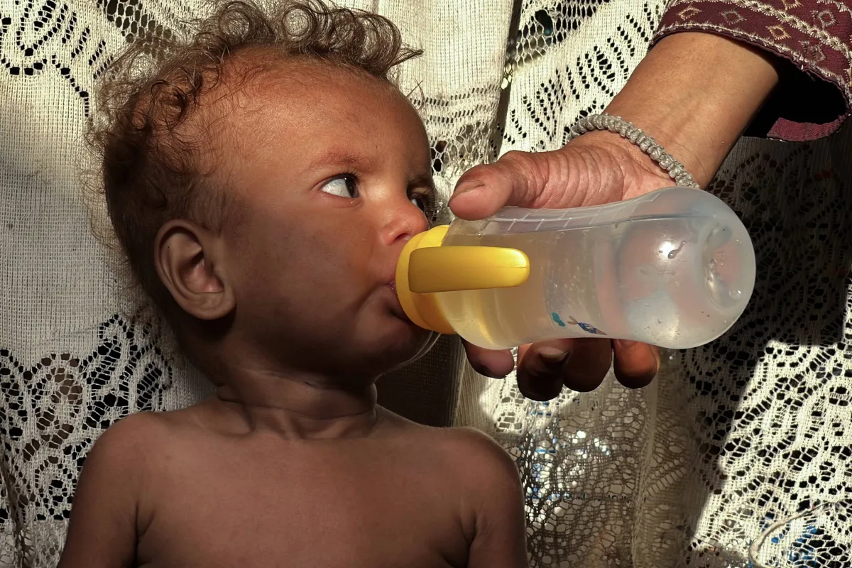 The death of civilians continue to bomb and hungry
Arabausa