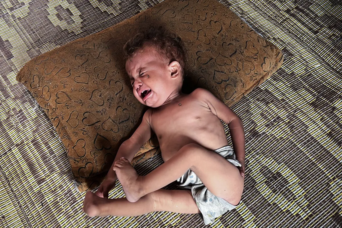 The number of death because of malnourity in Gaza increased to 222 people
Arabausa