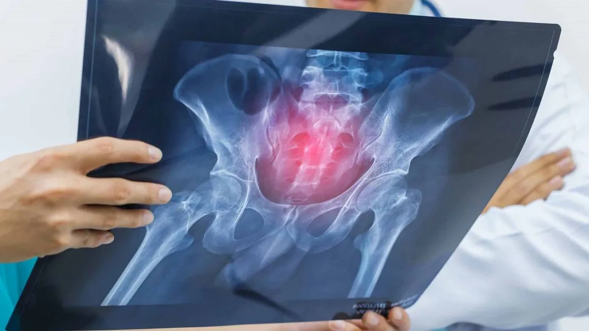 Warning signs indicate increased risk of osteoporosis

 Arabausa